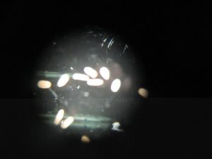 Microscopic view of coral larvae.